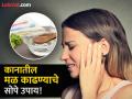 कानात चिकटून बसलेला मळ बाहेर कसा काढाल? जाणून घ्या सोपे घरगुती उपाय! - Marathi News | How to remove ear wax at home naturally | Latest health News at Lokmat.com