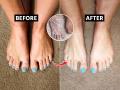 थंडीने पाय कोरडे-रुक्ष दिसतात? घरीच करा २ स्टेप पेडीक्युअर, पाय दिसतील स्वच्छ, इन्फेक्शनचा धोका नाही - Marathi News | 2 Step Easy Pedicure at home : Are your feet feeling dry and rough with the cold? Do 2 step pedicure at home, feet will look beautiful | Latest sakhi News at Lokmat.com