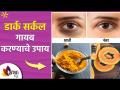 Dark Circles कायमस्वरूपी घालवण्यासाठी ३ घरगुती उपाय | Get Rid Of Dark Circles |Dark Circle Treatment - Marathi News | 3 Home Remedies to Get Rid of Dark Circles Permanently | Get Rid Of Dark Circles | Dark Circle Treatment | Latest sakhi Videos at Lokmat.com