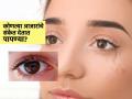 पापण्या सांगतात तब्येतीची अवस्था, ‘या’ ४ बदलांकडे दुर्लक्ष करणं पडेल महागात-स्वत:चे डोळे पाहा - Marathi News | What your eyelashes tells about your health, these 4 conditions should never ignore | Latest sakhi News at Lokmat.com