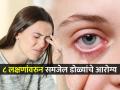धुसर दिसतं-डोळ्यातून सतत पाणी येतं? ८ लक्षणे सांगतात तुमची दृष्टी अधू होते आहे.. तपासा.. - Marathi News | Does it look blurry-is your eyes constantly watering Eye care tips warning signs 8 symptoms weakness and itching treatment low vision | Latest sakhi News at Lokmat.com