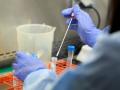 CoronaVirus अकोला जिल्ह्यात आणखी ११ पॉझिटिव्ह रुग्ण आढळले - Marathi News | Another 11 positive patients were found in Akola district | Latest akola News at Lokmat.com
