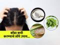 केसांतला कोंडा काही केल्या कमीच होत नाही? ५ सोपे उपाय, कोंडा होईल गायब - Marathi News | 5 Easy home remedies to treat hair dandruff : Dandruff in the hair does not reduce? 5 simple solutions, dandruff will disappear | Latest sakhi News at Lokmat.com