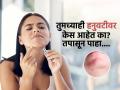हनुवटीवर दोनचार नाही तर अगदी दाढीसारखे भरमसाठ केस? महिलांचे फेशियल हेअर वाढण्याची ३ कारणं.. - Marathi News | 3 reasons why women grow facial hair, see and do remedies at home, skincare tips | Latest sakhi News at Lokmat.com