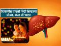 दिवाळीच्या आनंदात लिव्हर पडायचं आजारी, 'या' ४ गोष्टी टाळा नाही तर वाढेल फॅटी लिव्हरचा धोका - Marathi News | Diwali 2025 : Take Care of Your Liver This Diwali! These Daily Habits Can Increase the Risk of Fatty Liver Disease | Latest sakhi News at Lokmat.com