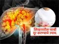 फॅटी लिव्हरसाठी आहारात करा ३ बदल, डॉक्टरांनी सांगितला खास उपाय-आहार ठरु शकेल औषध - Marathi News | Dr Saurabh Sethi tells how to detox fatty liver | Latest sakhi News at Lokmat.com