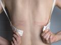 Bra that can be harmful : स्तनांसाठी नुकसानकारक ठरतात 'या' ४ प्रकारच्या ब्रा; चुकूनही विकत घेऊ नका - Marathi News | Types of bra that can be dangerous : These 4 types of bras are harmful for the breasts | Latest sakhi News at Lokmat.com