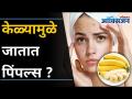 केळ्यामुळे जातात पिंपल्स? 5 Benefits of Banana for Skin and Hair I Remove Pimples | Lokmat Oxygen - Marathi News | Bananas cause pimples? 5 Benefits of Banana for Skin and Hair I Remove Pimples | Lokmat Oxygen | Latest oxygen Videos at Lokmat.com