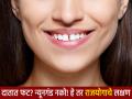 सामुद्रिक शास्त्र: तुमच्या दातांमध्ये फट आहे का? अभिनंदन! तुम्ही आहात 'या' बाबतीत प्रचंड नशीबवान! - Marathi News | Oceanography: Do you have a gap in your teeth? Congratulations! You are extremely lucky in this matter! | Latest bhakti Photos at Lokmat.com