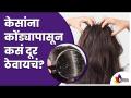 केसांमधील कोंडा कमी करण्यासाठी काही सोपे उपाय | Dandruff Problem? Know How To Get Rid Of It | Hair - Marathi News | Here are some simple ways to reduce dandruff Dandruff Problem? Know How To Get Rid Of It | Hair | Latest oxygen Videos at Lokmat.com