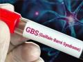 सांगलीत जीबीएस सिंड्रोमचा शिरकाव, सहा संशयित रुग्ण आढळले  - Marathi News | Six suspected cases of GBS syndrome were found in Sangli | Latest sangli News at Lokmat.com