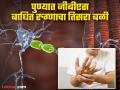GBS Outbreak: पुण्यात जीबीएस बाधित तिसऱ्या रुग्णाचा मृत्यू; रुग्णसंख्या १३० वर, २० जण व्हेंटिलेटरवर - Marathi News | Guillain Barre Syndrome: Third GBS patient dies in Pune; Number of patients reaches 130, 20 on ventilator | Latest pune News at Lokmat.com