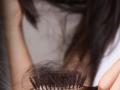 Hair Fall Stop Solution : केस खूपच गळतात? आजपासूनच ५ पदार्थ खाणं सोडा, अन्यथा टक्कल कधी पडेल कळणारही नाही - Marathi News | Hair Fall Stop Solution : Hair fall baldness risk before marriage stop eating junk fast foods egg white fish alcohol | Latest sakhi News at Lokmat.com