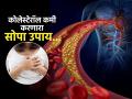 Heart Attack टाळायचा असेल तर रोज खा स्वयंपाकघरातला ‘हा’ पदार्थ, कमी होईल कोलेस्टेरॉल - Marathi News | Doctor Saleem Zaidi told how to consume ginger to get rid of cholesterol heart attack | Latest sakhi News at Lokmat.com