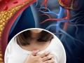 Heart Attack टाळायचा असेल तर रोज खा स्वयंपाकघरातला ‘हा’ पदार्थ, कमी होईल कोलेस्टेरॉल - Marathi News | Doctor Saleem Zaidi told how to consume ginger to get rid of cholesterol heart attack | Latest sakhi News at Lokmat.com