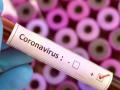 CoronaVirus in Nagpur : नागपुरात ९८२ नवीन पॉझिटिव्ह, ३८ रुग्णांचा मृत्यू - Marathi News | Corona Virus in Nagpur: 982 new positive, 38 patients die in Nagpur | Latest nagpur News at Lokmat.com