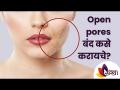 ओपन पोर्स बंद कसे करायचे? How To Get Rid Of Open Pores? Know Easy Home Remedies | Lokmat Sakhi - Marathi News | How to close open pores? How To Get Rid Of Open Pores? Know Easy Home Remedies | Lokmat Sakhi | Latest oxygen Videos at Lokmat.com