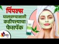 चेहऱ्यावरील पिंपल्स साठी कढीपत्त्याचा घरगुती रामबाण उपाय | Benefits of curry leaves for pimples - Marathi News | Curry Home Remedy for Facial Pimples | Benefits of curry leaves for pimples | Latest sakhi Videos at Lokmat.com