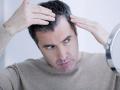 तुमच्या 'या' सवयींमुळे पांढरे होतात तुमचे केस! - Marathi News | Common mistakes to avoid for grey hair | Latest beauty News at Lokmat.com