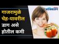 त्वचा,डोळे,दात आणि पाचक प्रणालींसाठी गाजर फायदेशीर | Carrot Benefits I Hair and Skin | Lokmat Oxygen - Marathi News | Carrots are beneficial for skin, eyes, teeth and digestive system Carrot Benefits I Hair and Skin | Lokmat Oxygen | Latest oxygen Videos at Lokmat.com