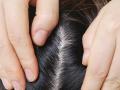 Hair Care Tips : केस घनदाट, लांबसडक होण्यासाठी तज्ज्ञ सांगतात ५ सोपे नॅचरल उपाय... - Marathi News | | Latest sakhi News at Lokmat.com
