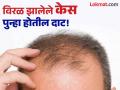 डोक्यावर पुन्हा केस उगवण्यासाठी ट्राय करा हे नॅचरल उपाय, टोपी घालून फिरणं होईल बंद! - Marathi News | Use these home remedies for make hair growth superfast | Latest beauty News at Lokmat.com