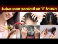 केसांच्या सर्व समस्यांसाठी करा हा उपाय | How to Get Rid of Hair Problems | Hair Oil Homemade | MA 2 - Marathi News | Do this remedy for all hair problems How to Get Rid of Hair Problems | Hair Oil Homemade | MA 2 | Latest sakhi Videos at Lokmat.com