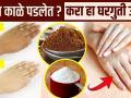 हातांचं tanning घालवण्यासाठी घरगुती उपाय | How To Remove Tan From Hands | Tan Removal Home Remedies - Marathi News | Home remedies to get rid of hand tanning How To Remove Tan From Hands | Tan Removal Home Remedies | Latest beauty Videos at Lokmat.com