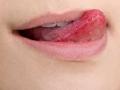 कोरड्या ओठांवरुन जीभ फिरवणं पडेल महागात! होऊ शकतो 'लीप सिकींग सिंड्रोम'चा गंभीर आजार - डर्मेटोलॉजिस्ट सांगतात... - Marathi News | | Latest sakhi News at Lokmat.com