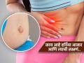 हर्नियाचं दुखणं कधी मागे लागलं कळणारही नाही, छळतील वेदना; पाहा हर्नियाची गंभीर लक्षणं आणि उपाय - Marathi News | What is hernia? know about the symptoms and how to prevent it | Latest sakhi News at Lokmat.com