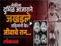Kolhapur: लेक एसएसपीई या दुर्मिळ आजाराने ग्रस्त, वडिलांनी परदेशातून आणले इंजेक्शन; पुजारी कुटुंबियांची हृदयद्रावक कहाणी - Marathi News | Sagar Pujari's daughter from Hatkanangle taluka in Kolhapur suffers from a rare disease called SSPE Injections brought from abroad for treatment | Latest kolhapur News at Lokmat.com
