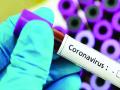 CoronaVirus in Nagpur : ८८ दिवसानंतर बाधितांची संख्या २५७ - Marathi News | Corona virus in Nagpur: 257 infected after 88 days | Latest nagpur News at Lokmat.com