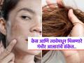 त्वचा आणि केसांचा बदलता रंग-पोत सांगतो गंभीर आजाराचा धोका, डॉक्टर सांगतात अचानक बदल दिसला तर.. - Marathi News | Health signs of poor health on skin and hair, doctor tells the details | Latest sakhi News at Lokmat.com