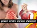 हार्टमध्ये ब्लॉकेज आहे की नाही लक्षणांवरुन ओळखता येतं, डॉक्टरांकडे जाण्यापूर्वी सावध व्हा - Marathi News | Naturopath expert told bend middle finger of hand to check heart blockage | Latest sakhi News at Lokmat.com