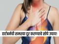 काहीही खाल्लं की छातीत जळजळ होते? करा 'हे' सोपे उपाय, लगेच मिळेल आराम! - Marathi News | Do you get heartburn after eating anything? Use this simple remedy, you will get immediate relief! | Latest sakhi News at Lokmat.com