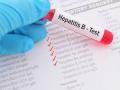 निदान झाल्यास हिपॅटायटिसवर नियंत्रण शक्य! - Marathi News | Control possible of hepatitis if diagnosed! | Latest akola News at Lokmat.com