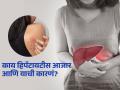 World Hepatitis Day 2025: ‘या’ घातक सवयींमुळे वाढतंय हिपॅटायटीसचं प्रमाण, पाहा धोके आणि उपाय - Marathi News | World Hepatitis Day 2025 : What is the causes, saymtoms of liver disease hepatitis | Latest sakhi News at Lokmat.com