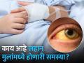 हेपेटायटिसचा लहान मुलांवर होणारा दीर्घकालीन परिणाम - Marathi News | Long-term effects of hepatitis on children | Latest health News at Lokmat.com