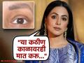 केमोथेरपीमुळे हिना खानच्या पापण्यांवरील केसही झाले विरळ; फोटो शेअर करत दिली हेल्थ अपडेट - Marathi News | hindi television actress hina khan last chemotherapy left single eyelash on her eyes | Latest filmy News at Lokmat.com