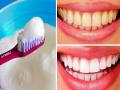 How to Whiten Teeth in 2 Minutes : रोज स्वच्छ दात घासूनही पिवळे दिसतात? दातांवरचा पिवळा थर काढून टाकतील हे ५ पदार्थ - Marathi News | How to Whiten Teeth in 2 Minutes : 5 best and effective kitchen ingredients to whiten teeth at home | Latest sakhi Photos at Lokmat.com