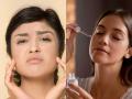 Skin Care: हिवाळ्यासाठी घरीच तयार करा नाईट क्रिम, थंडीत त्वचा कोरडी होणारच नाही - Marathi News | home made night cream for winter, how to get rid of dry skin in winter season, how to use glycerine for skin | Latest sakhi Photos at Lokmat.com