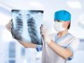 Corona Virus: कोरोना व्हायरसने शरीरात प्रवेश केल्यास काय होतं नुकसान? 'या' रुग्णांचा होतो मृत्यू - Marathi News | Corona Virus: What happens if corona virus enters the body? These 'patients' die pnm | Latest health Photos at Lokmat.com