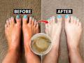 पायावर काळे घट्टे पडले? 'अशी’ लावा टुथपेस्ट- फक्त १० मिनिटांत मिळेल पेडिक्युअरसारखा इफेक्ट - Marathi News | how to clean feet using toothpaste, how to do pedicure at home, home hacks to do pedicure at home, how to get pedicure like effect at home  | Latest sakhi News at Lokmat.com
