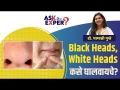 Black Heads - White Heads कसे दूर करावेत? | How To Remove Blackheads & Whiteheads | Ask the Expert - Marathi News | How to get rid of Black Heads - White Heads? | How To Remove Blackheads & Whiteheads | Ask the Expert | Latest beauty Videos at Lokmat.com