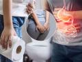 Immediate Constipation Relief at Home : सकाळी पोट व्यवस्थित साफ होत नाही? ३ उपाय, कॉन्स्टीपेशन त्रासच दूर होईल - Marathi News | Immediate Constipation Relief at Home : Home remedies for Constipation Relief | Latest sakhi Photos at Lokmat.com
