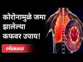 Coronaमुळे गळ्यात आणि फुफ्फुसात जमा होतो Cough | 3 उपाय | Corona virus In Maharashtra - Marathi News | Corona causes accumulation in the neck and lungs 3 remedies | Corona virus in Maharashtra | Latest maharashtra Videos at Lokmat.com