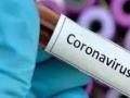 CoronaVirus in Khamgaon : बाहेरगावहून आलेल्या हजारावर नागरिकांची तपासणी अपूर्ण! - Marathi News | CoronaVirus in Khamgaon: Investigation of thousands of citizens from out-of-town is incomplete! | Latest buldhana News at Lokmat.com