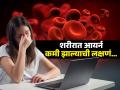 सतत थकवा, डोकं दुखतं-शक्ती कमी म्हणजे शरीरात आयर्नची कमतरता, पाहा मोठ्या त्रासाची सुरुवातीची लक्षणं - Marathi News | Iron deficiency symptoms : Signs of Anemia you should not ignore | Latest sakhi News at Lokmat.com