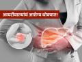 धक्कादायक! आयटी क्षेत्रात काम करणाऱ्या ८० टक्के लोकांना फॅटी लिव्हर डिजीज, रिसर्चमधून खुलासा! - Marathi News | Study revealed 84 percent IT employee have fatty liver disease | Latest sakhi News at Lokmat.com