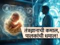 मेडिकल सायन्सचा चमत्कार! नव्या IVF टेक्निकने पालक ठरवणार मुलाच्या डोळ्यांचा-त्वचेचा रंग - Marathi News | miracle of medical science new ivf technology allows parents to decide how their child will look | Latest sakhi News at Lokmat.com